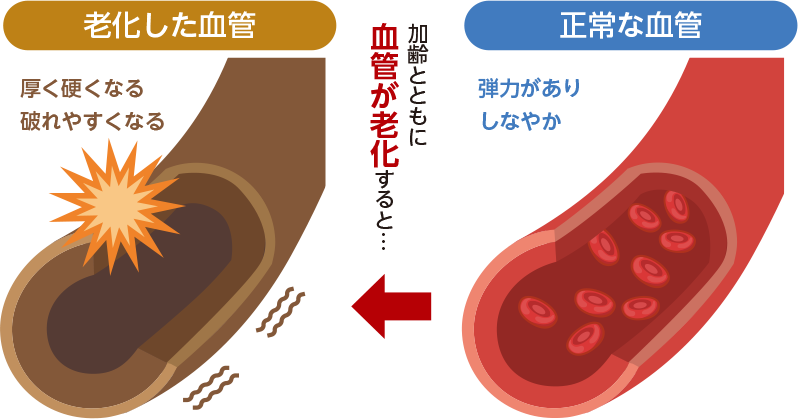 血管の老化