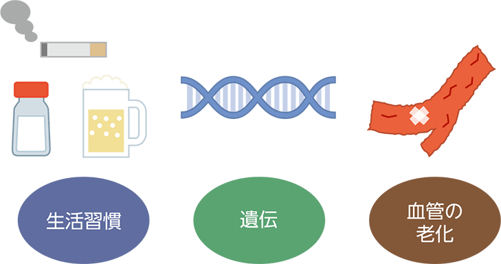 高血圧のさまざまな要因